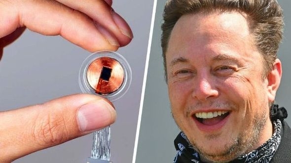 Neuralink dobio dozvolu za ugradnju moždanog čipa u još jednog pacijenta