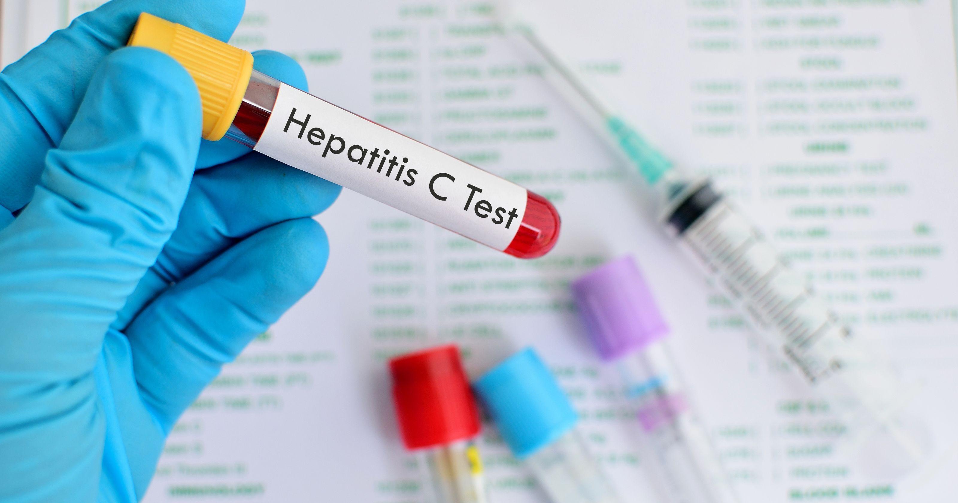 Efikasniji lijekovi za hepatitis C