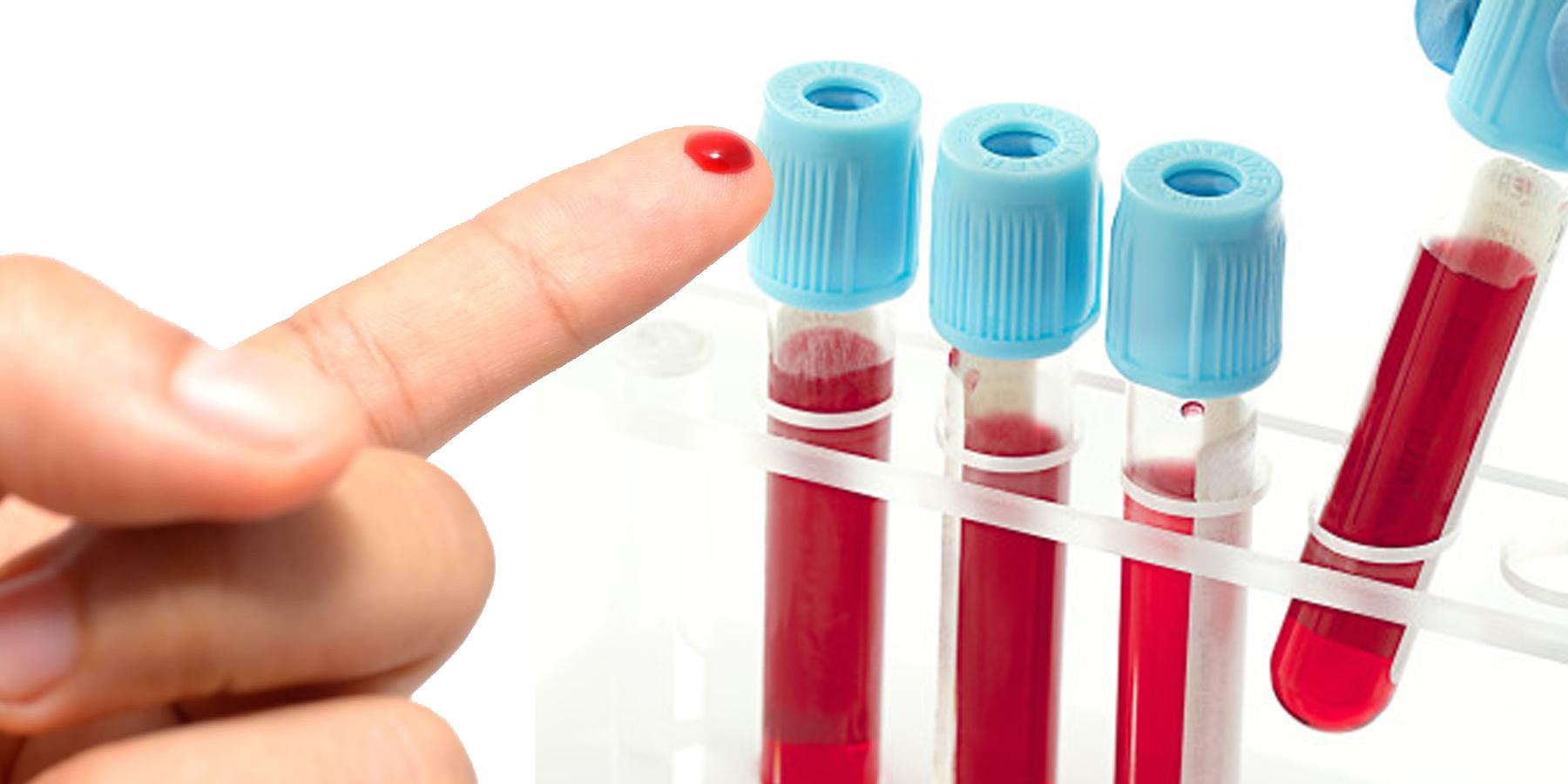 Zašto treba znati svoju krvnu grupu