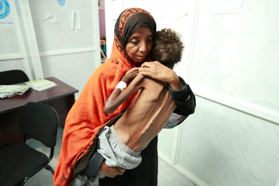 Desetine regija u Jemenu treba hitnu humanitarnu pomoć: 80 posto stanovništva živi na rubu egzistencije