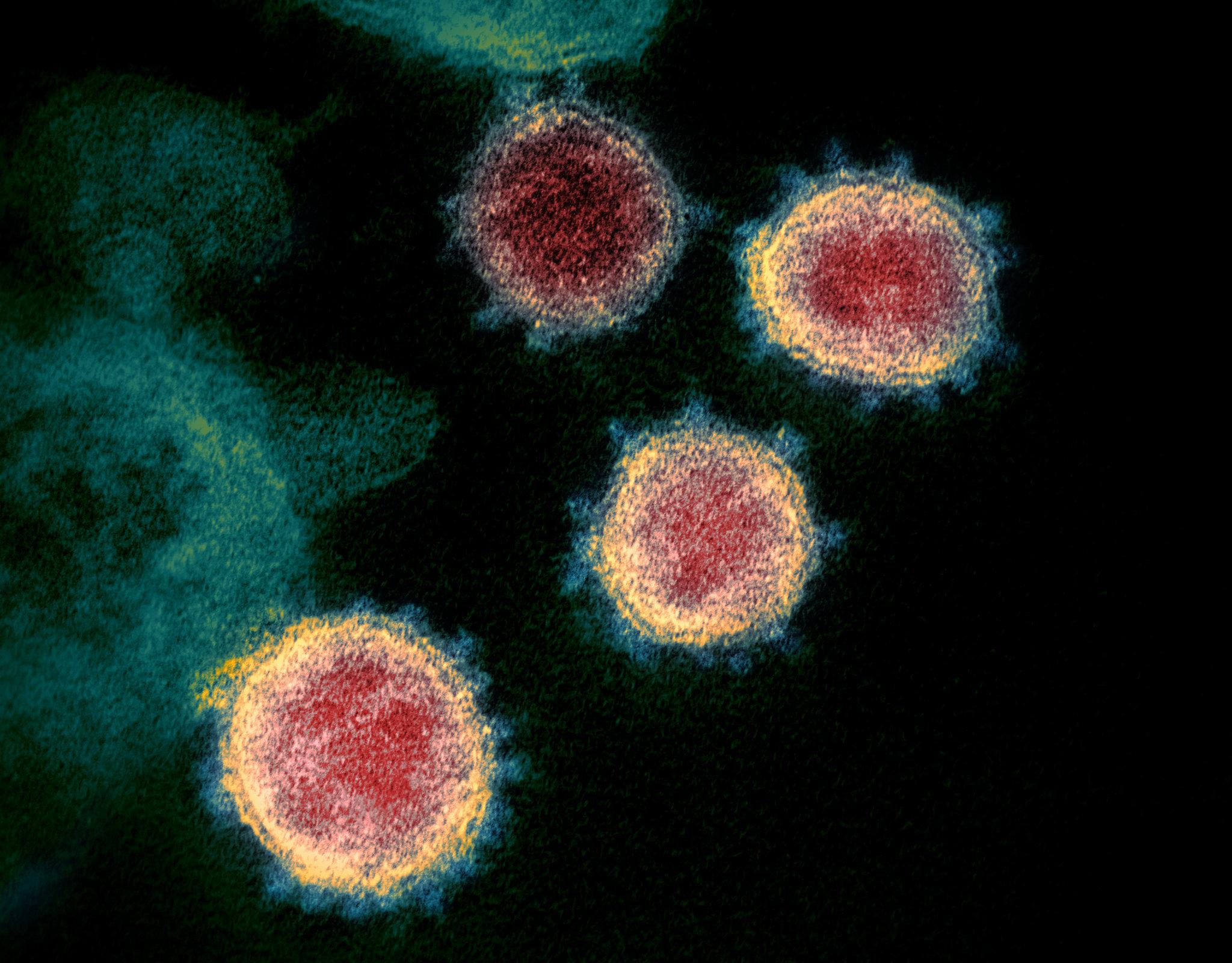 Virusni RNA otkriven je u uzorcima zraka - Avaz