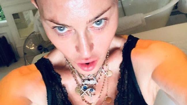 Zastrašujuće: Madona objavila fotografije na Instagramu i šokirala pratioce