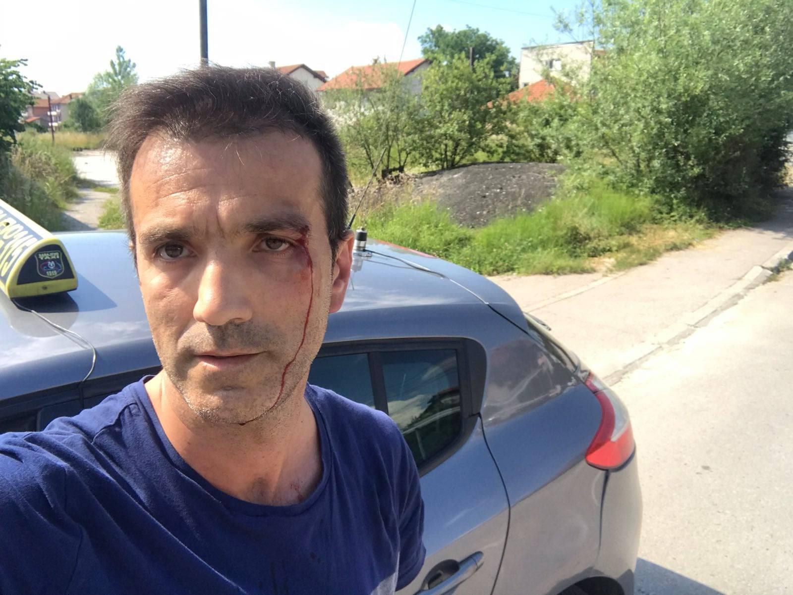 Napadnuti taksista Mirza Geljo: Udarali su me šakama u lice dok nisam uspio da se izvučem