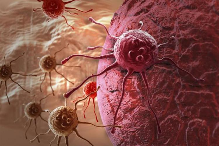 Neutrofili donatora ubijaju rak za 24 sata!