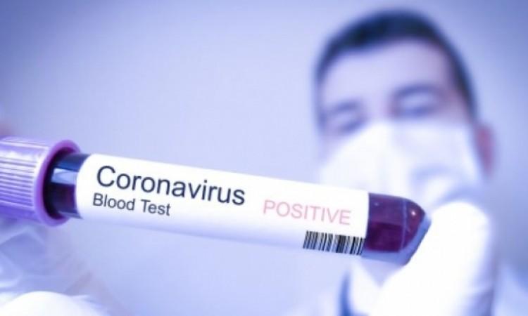 Slučaj 62-godišnjeg pacijenta: Kako su povezani koronavirus i četverosatna erekcija?