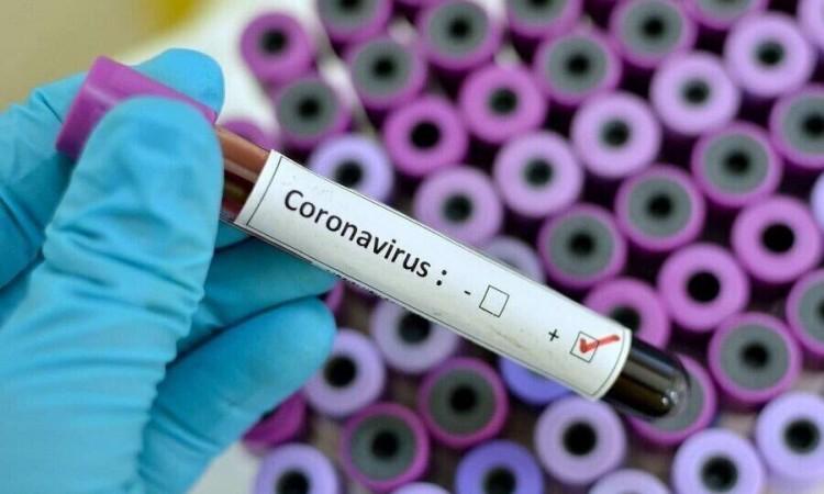 U Federaciji BiH 275 novozaraženih koronavirusom, preminulo troje