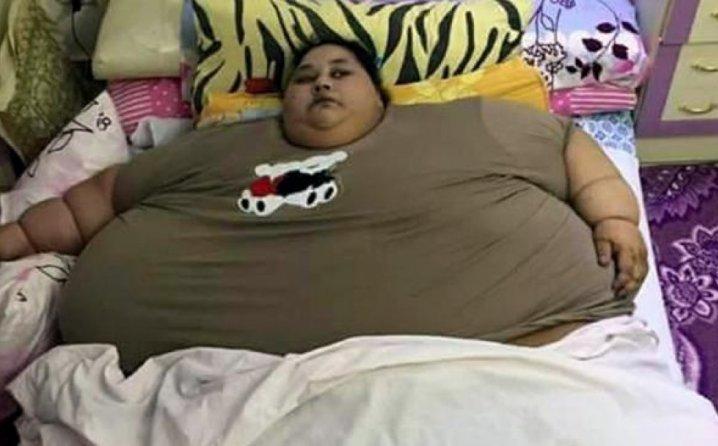 Egipćanka teška 500 kg 25 godina nije izašla iz kuće