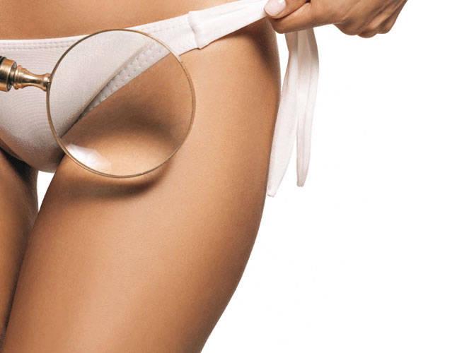 Intimna higijena: Tange i brazilska depilacija najveći su neprijatelji svake žene