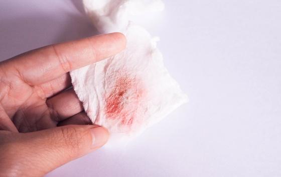 Zašto dermatolozi ne vole maramice za skidanje šminke