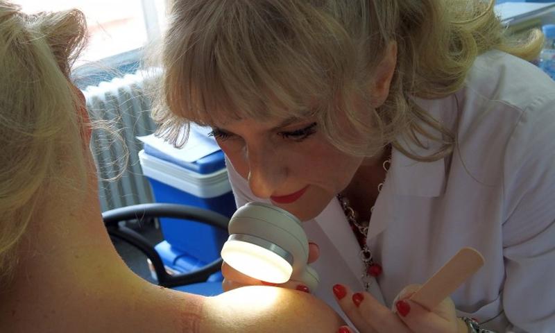 Preventivnim pregledima kože otkrili opasne melanome kod nekoliko pacijenata