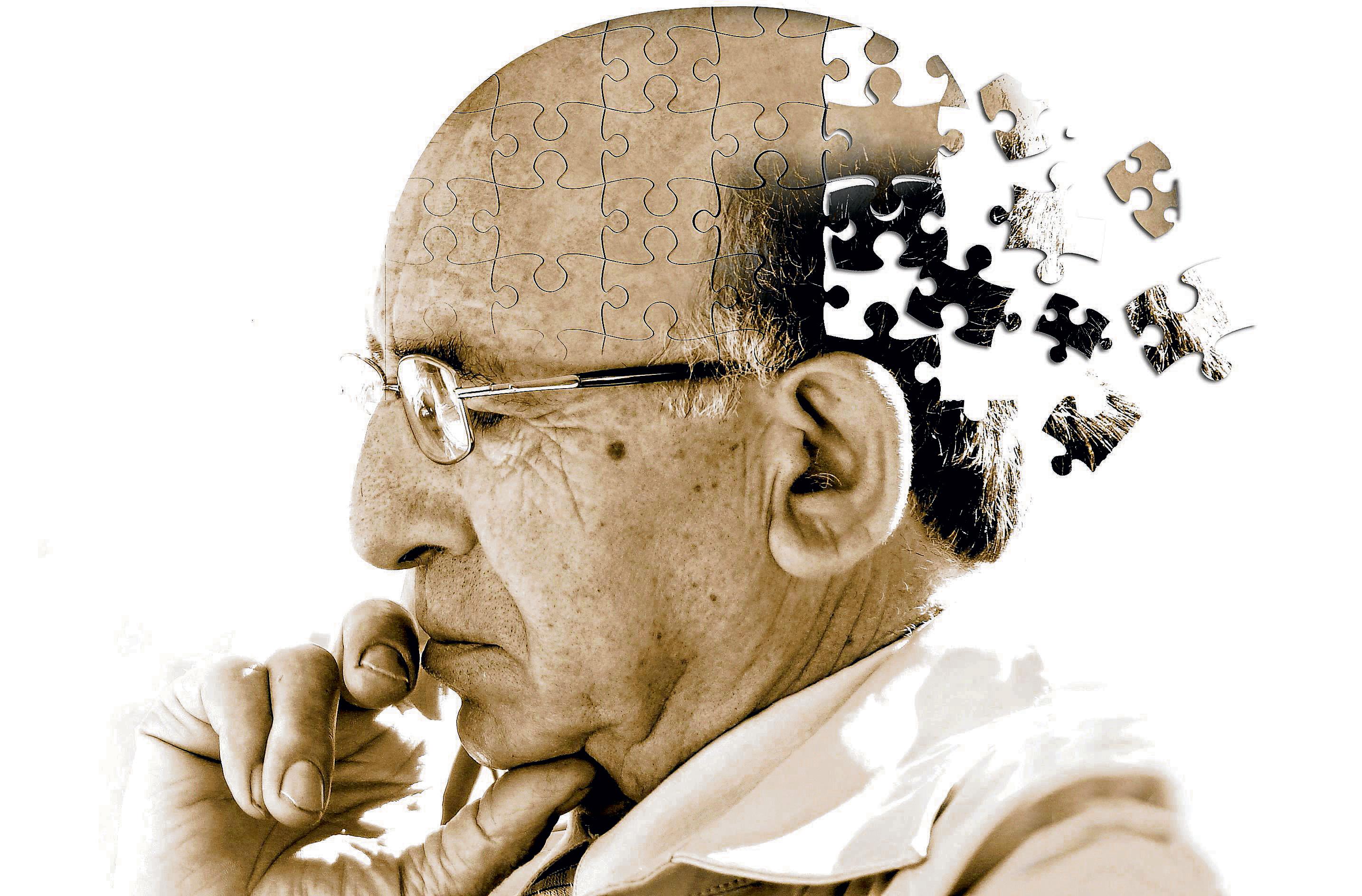 Novi lijek za Alzheimerovu bolest