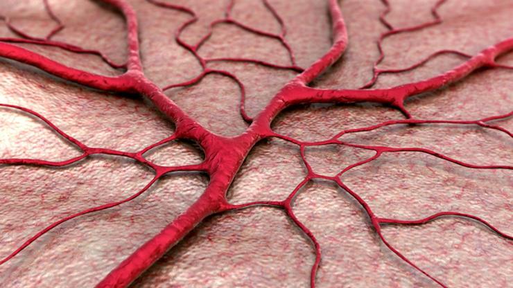 Krute krvne žile – najava demencije?