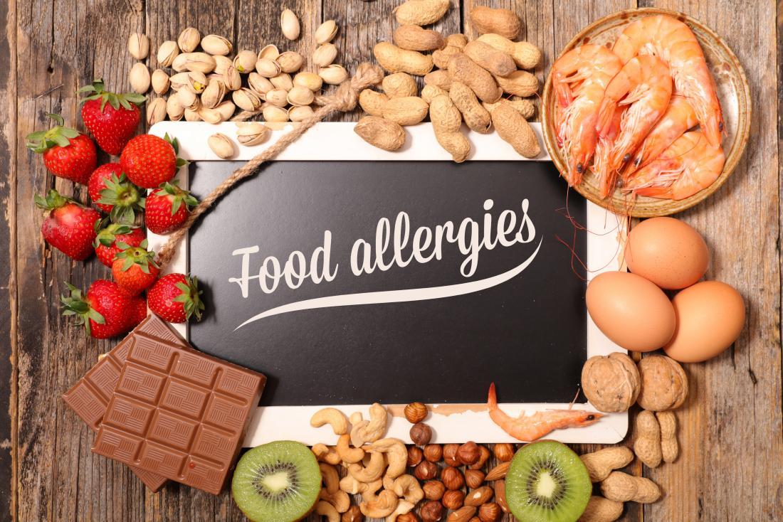 Alergija je reakcija imuniteta na hranu - Avaz