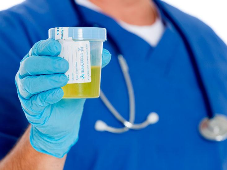 Prisustvo bakterija u mokraći može se utvrditi pregledom urina - Avaz