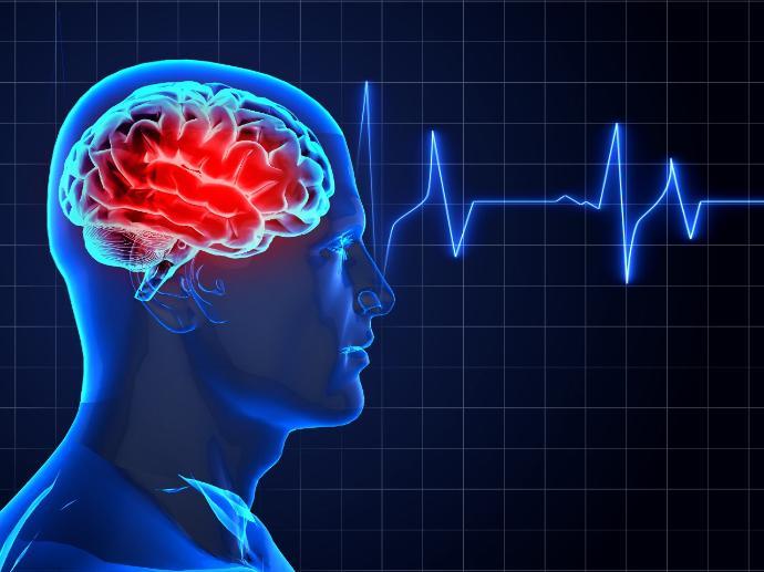 Koji su rizici za moždani udar?
