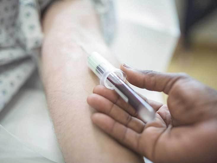 Test krvi za liječenje limfoma