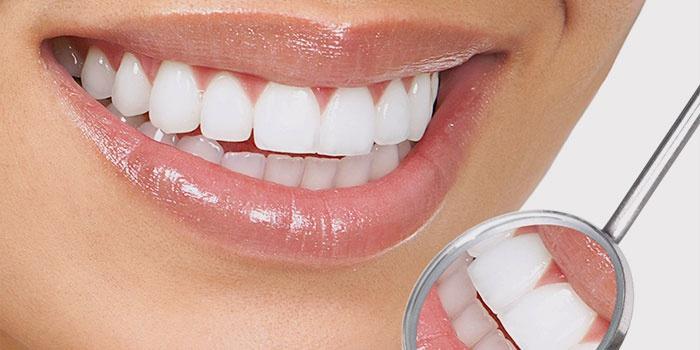 Bakterije iz zubnih naslaga povećavaju krvni pritisk - Avaz