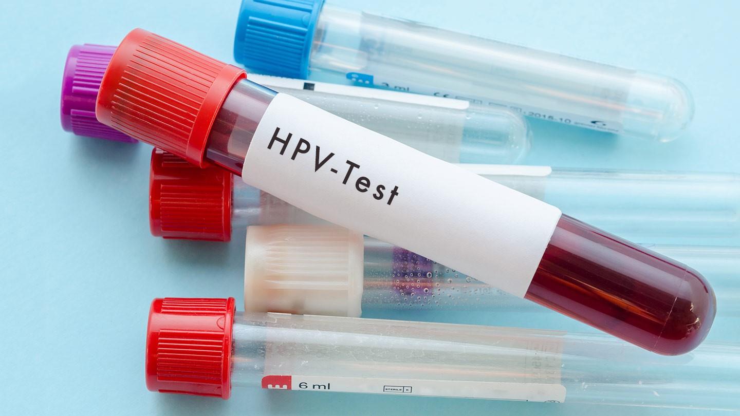 Vakcine protiv HPV-a moguće samo kupiti, i to za 360 KM!