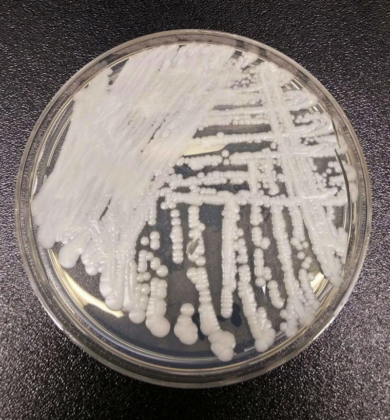 Smrtonosna bakterija prijeti svijetu: Amerikanci u panici