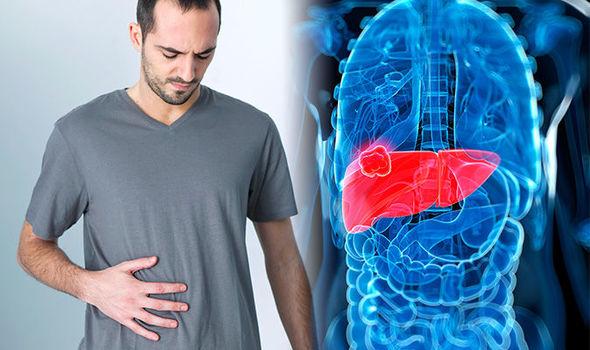 Masna jetra ili steatoza posljedica je nakupljanja masti u jetri - Avaz
