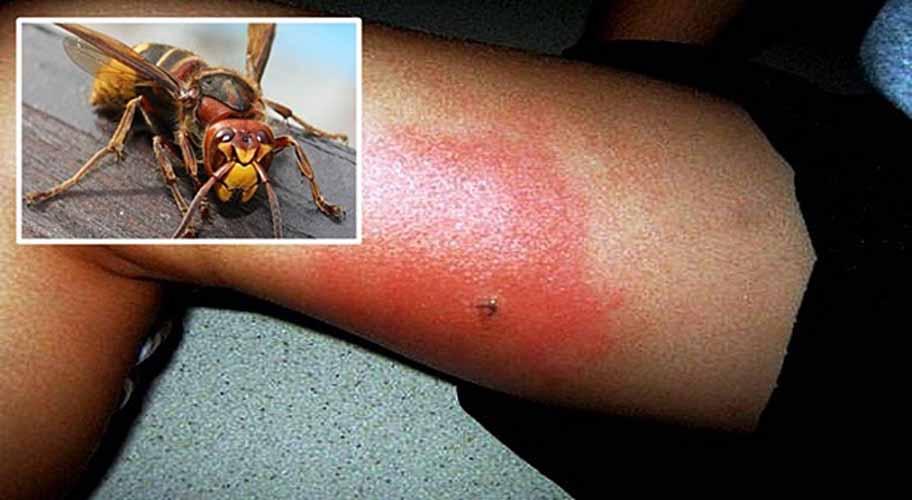 Alergija na ubod pčele ili ose: Svaki ubod može biti smrtonosan