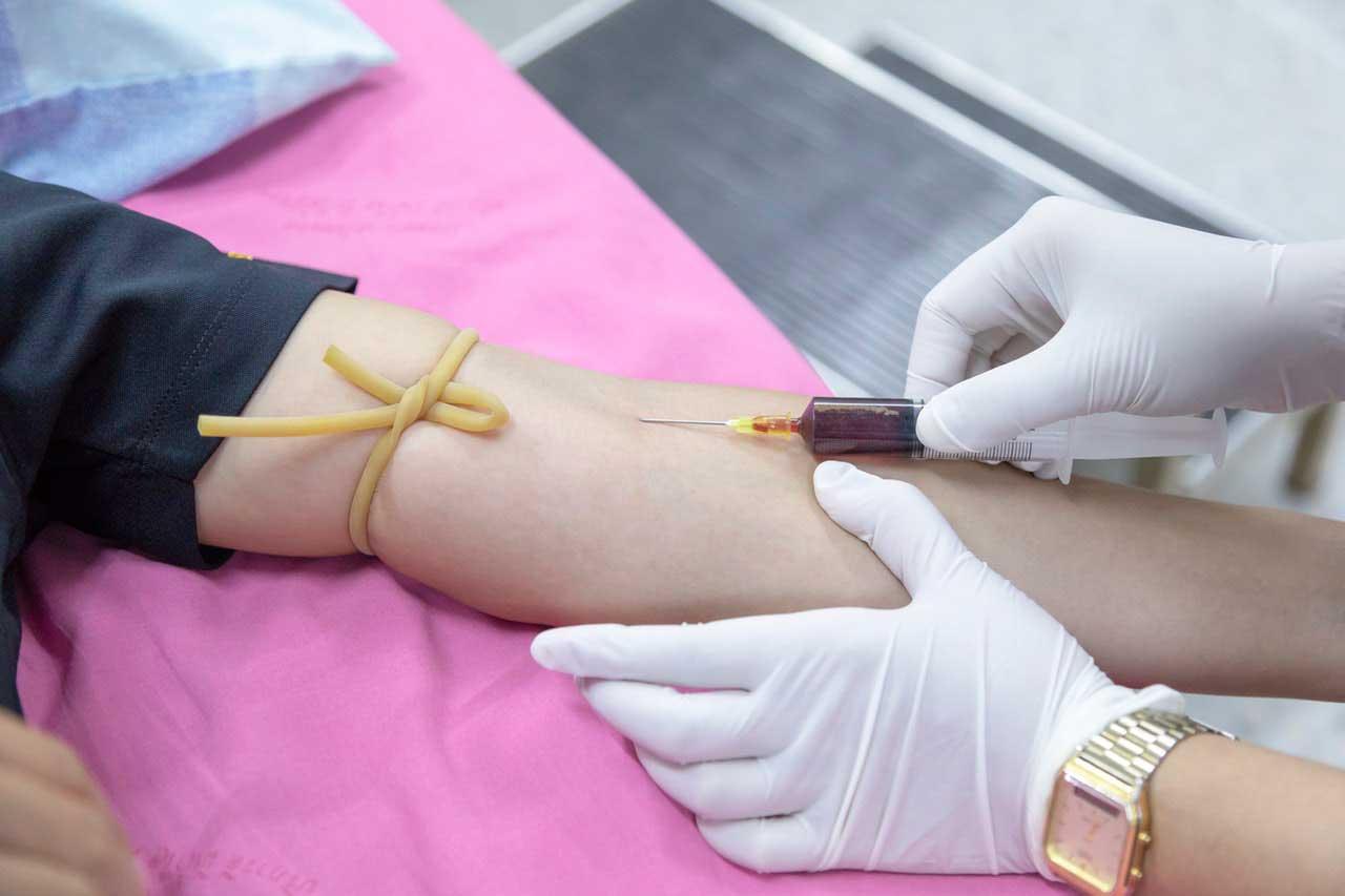 Zlatnu krvnu grupu ima samo 43 ljudi na svijetu!