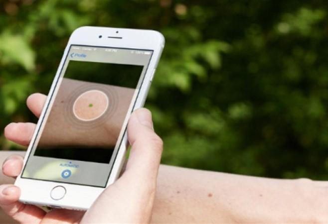 Ova mobilna aplikacija prepoznaje rak kože