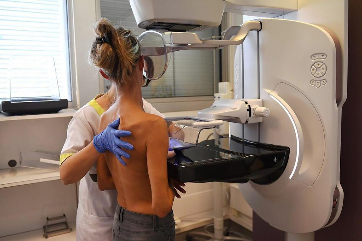 Bez uputnica i čekanja 32.000 žena besplatno će obaviti mamografiju