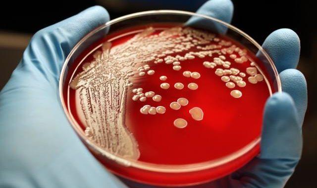 Mrsa je bakterija otporna na širok spektar antibiotika - Avaz