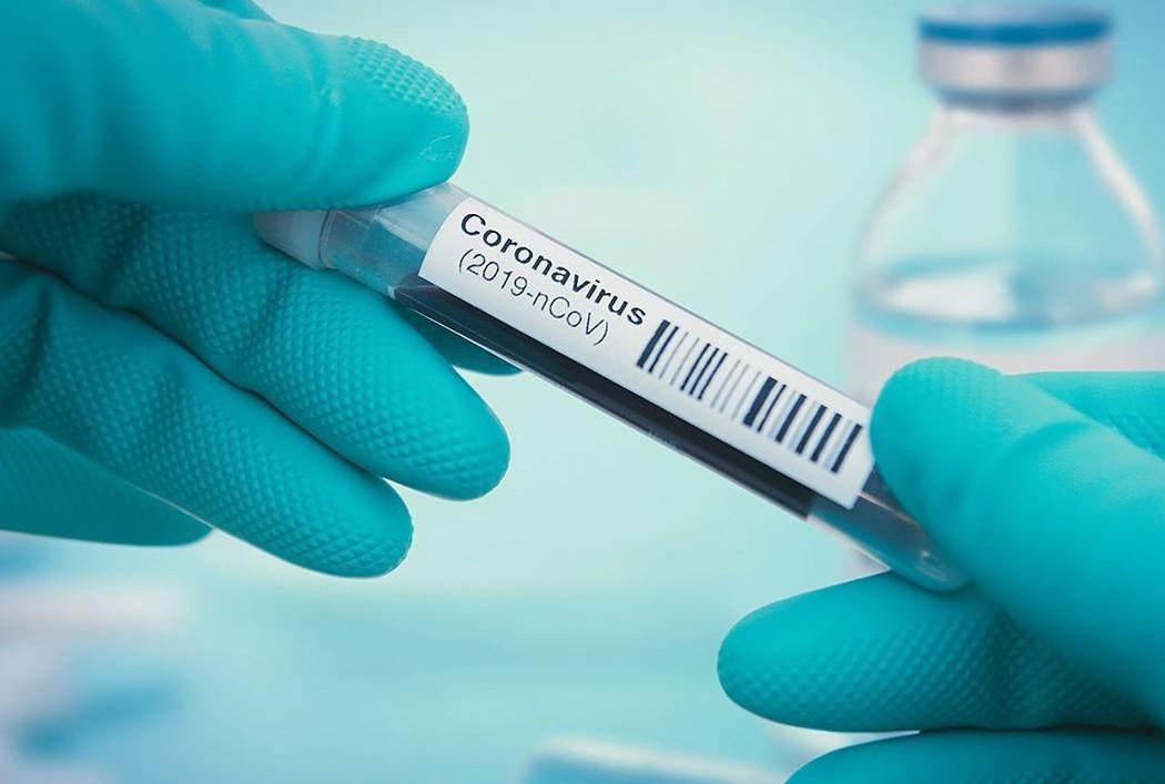 Zašto koronavirus češće pogađa muškarce nego žene?