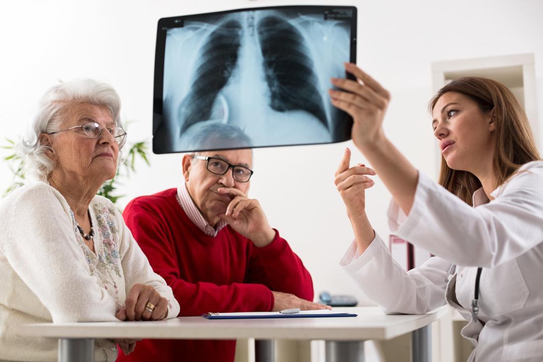 Hronične bolesti donjeg sistema za disanje treći su najčešći uzrok smrti starijih od 65 godina - Avaz