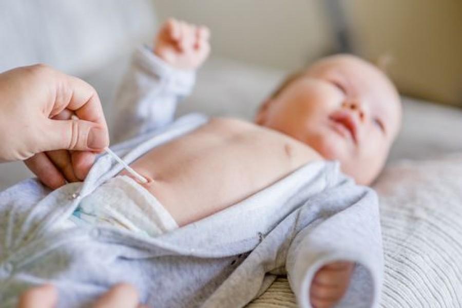 Najčešće patološke promjene pupka u novorođenčeta