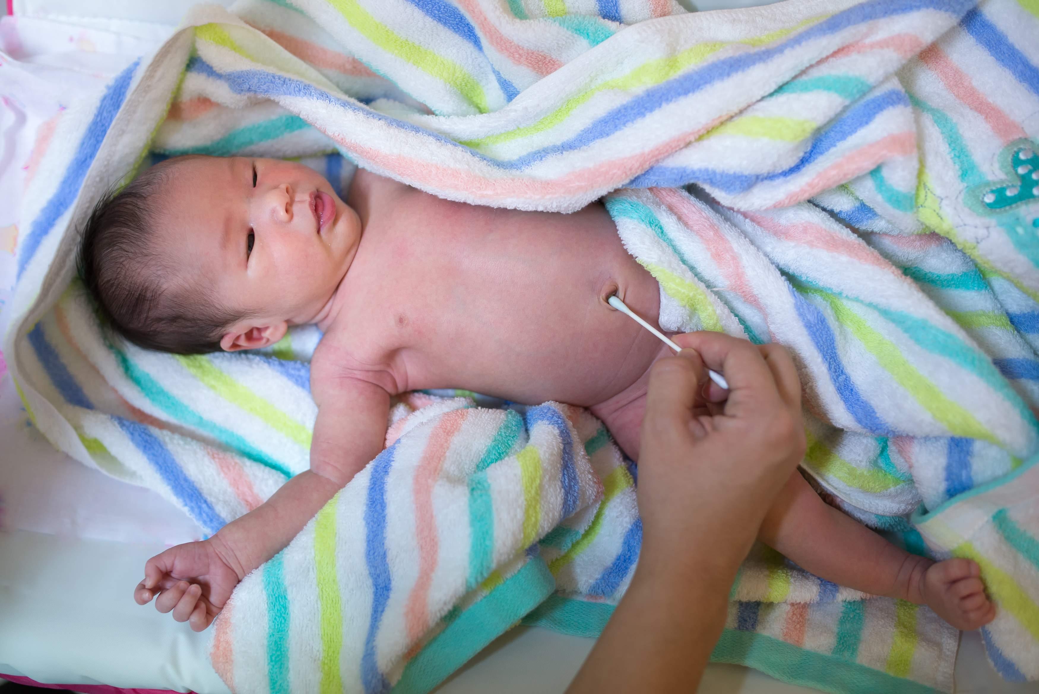 Šta je umbilikalni granulom i kada se javlja kod novorođenčadi