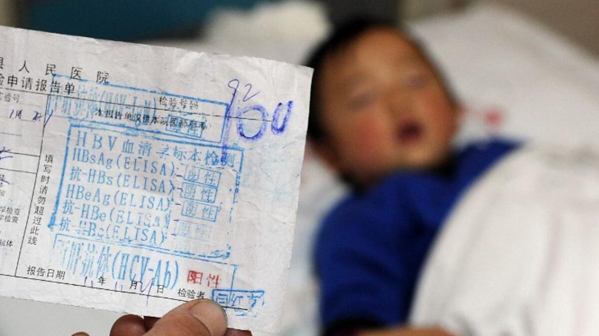 Nakon smrti troje djece u Indoneziji otkriveno 15 slučajeva teškog hepatitisa