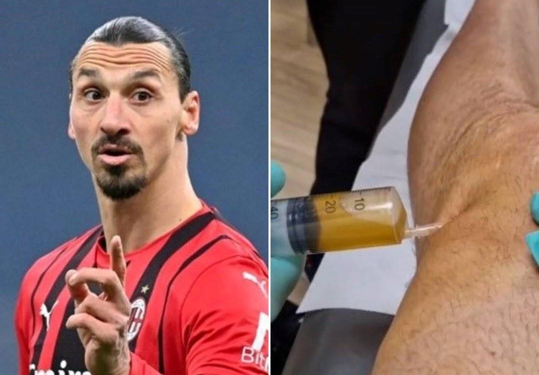 Podijelio neugodan video: Ibrahimović pokazao proces vađenja vode iz svog koljena