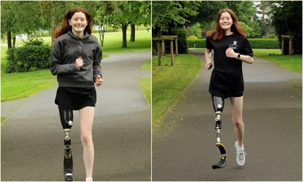 Amputirali joj nogu, a sada prvi put poslije 11 godina trči uz pomoć proteze
