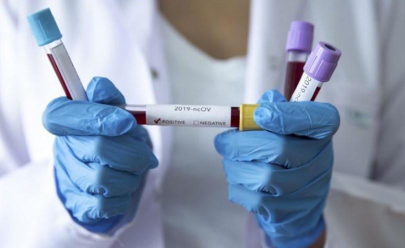 Zabilježeno 1.111 novih slučajeva zaraze koronavirusom u Hrvatskoj, preminulo 12 osoba