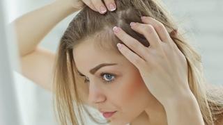 Pet prirodnih načina da spriječite gubitak kose