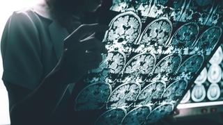 Lijek za Alzheimer prošao početnu fazu testiranja
