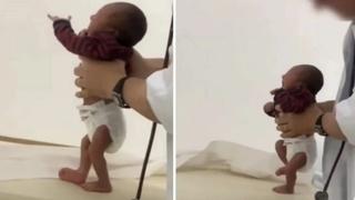 "Gdje je pošla": Snimak tek rođene bebe koja pravi prve korake pogledalo 18 miliona ljudi