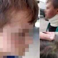 Žena koja je pretukla 9-godišnjaka u osnovnoj školi u Sarajevu osumnjičena za nasilničko ponašanje 