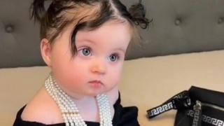 O ovoj bebi bruji internet: Djevojčica prelijepih očiju izazvala brojne reakcije, a evo i zbog čega