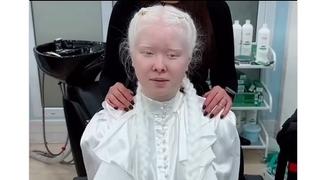 Pogledajte nevjerovatnu transformaciju albino djevojke: Prelijepa brineta osvojila je internet