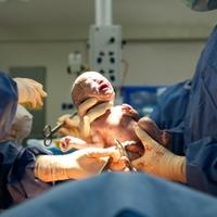 Šta beba osjeća tokom porođaja: Najveća dilema je da li je boli 