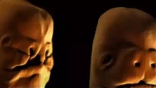 Simulacija kako se razvija bebino lice mnogima uzrokovala noćne more: ''Proganjat će me u snovima''