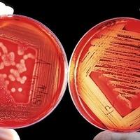 Pronađen jedinstven antibiotik na koji bakterije nemaju odgovor