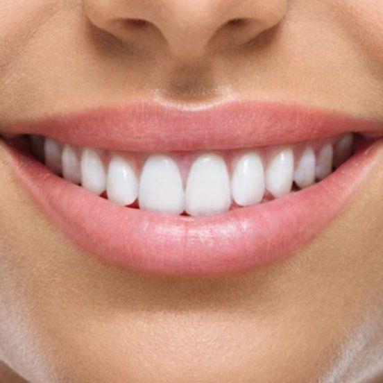 Mitovi o zubima
