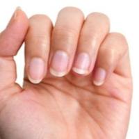 Evo šta otkrivaju vodoravni ili okomiti nabori na noktima, a šta bijele tačke ispod njih