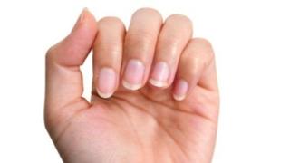 Evo šta otkrivaju vodoravni ili okomiti nabori na noktima, a šta bijele tačke ispod njih