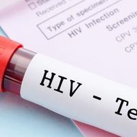 Svjetski dan borbe protiv HIV-a: Kako se prenosi infekcija i koje radnje vas neće ugroziti